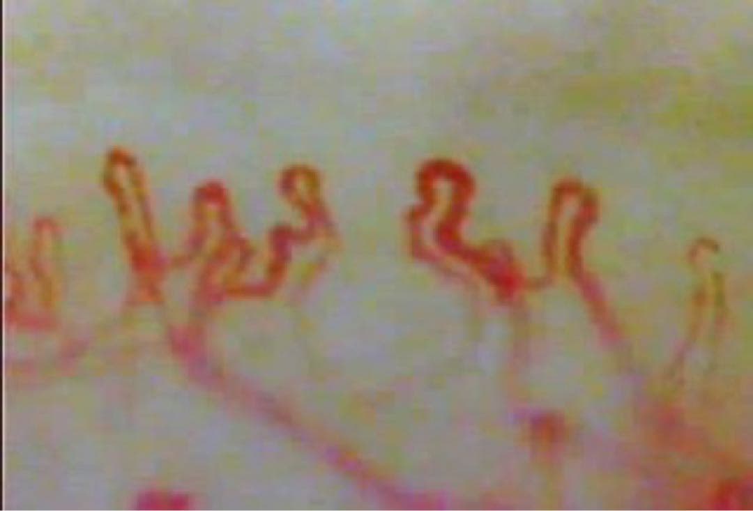 毛細血管スコープ　血管美人　SC-10