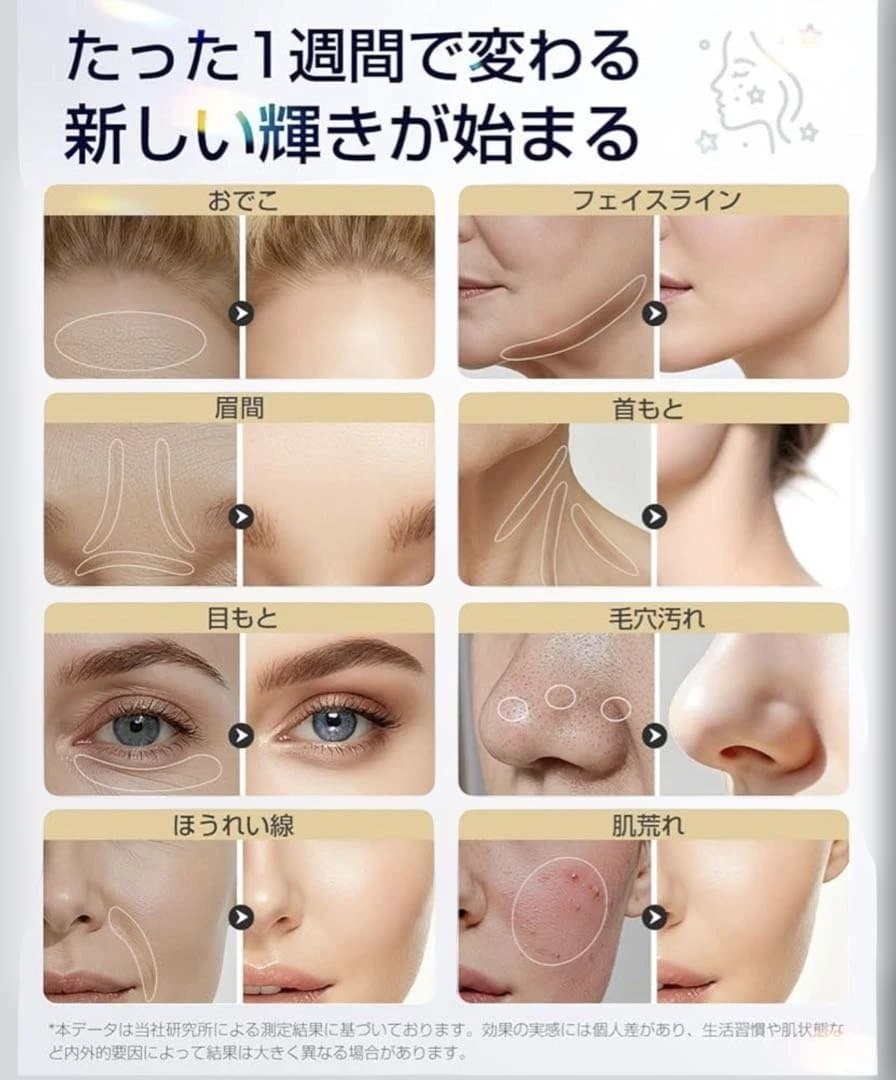 【新品未開封】美顔器 高周波 RF EMS MC 1台18役 温冷