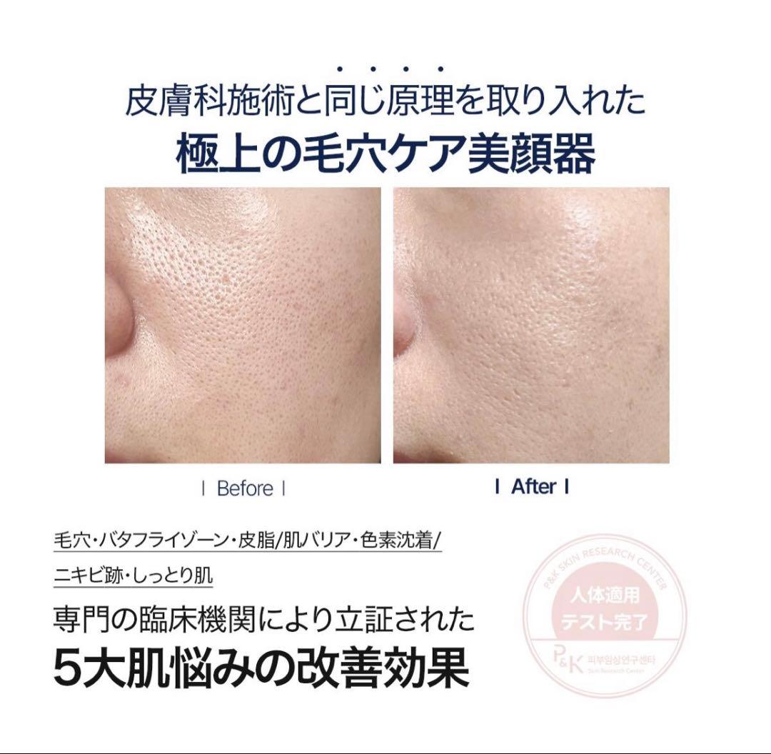 美顔器 韓国エステ 美容家電 美容機器 セロラバイ ペンタショット