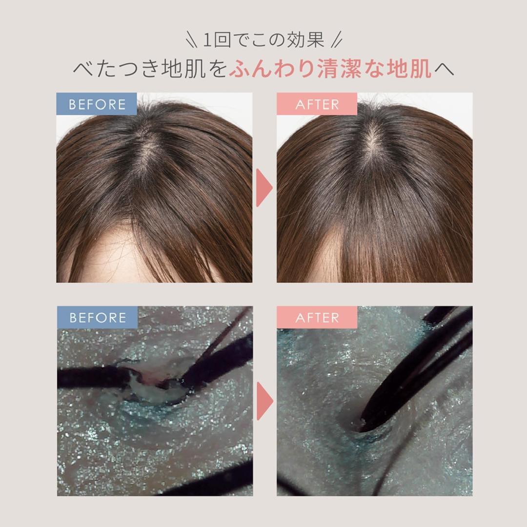 タク【新品・未使用】ヤーマン ヘッドスパ ミーゼ ニードルヘッドスパリフト