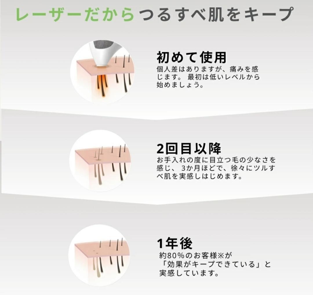 レーザー脱毛器 トリア 4X